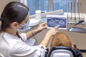 Young female dentist showing a patient a dental x-ray. Dentistry concept. High quality photo. Dentist at work. Dentist and patient.